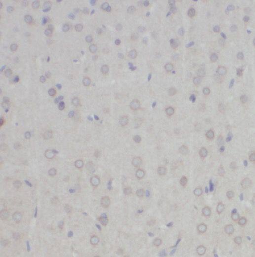 Immunohistochemistry: NYAP2 Antibody - BSA Free [NBP3-47273] - Immunohistochemistry of paraffin-embedded mouse brain tissue slide using (NYAP2 Antibody) at dilution of 1:50