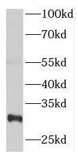 Western Blot: NUP62CL Antibody - BSA Free [NBP3-47281] - HeLa cells were subjected to SDS PAGE followed by western blot with ( NUP62CL Antibody) at dilution of 1:600