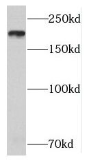 Western Blot NUP205 Antibody - BSA Free