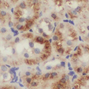 Immunohistochemistry: NUDT19 Antibody - BSA Free [NBP3-47288] - Immunohistochemistry of paraffin-embedded human kidney using (NUDT19 antibody) at dilution of 1:50