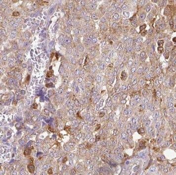 Immunohistochemistry NUDT11 Antibody - BSA Free