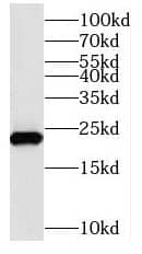 Western Blot: NUDT10 Antibody - BSA Free [NBP3-47292] - Mouse brain tissue were subjected to SDS PAGE followed by western blot with (NUDT10 antibody) at dilution of 1:2000