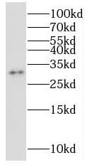 Western Blot: NUBP2 Antibody - BSA Free [NBP3-47295] - L02 cells were subjected to SDS PAGE followed by western blot with (NUBP2 antibody) at dilution of 1:500