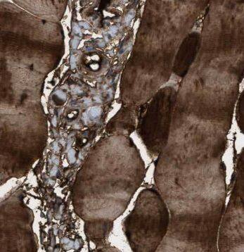 Immunohistochemistry: NT5C Antibody - BSA Free [NBP3-47301] - Immunohistochemistry of paraffin-embedded human skeletal muscle tissue slide using (NT5C Antibody) at dilution of 1:50