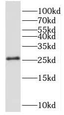 Western Blot: NRSN2 Antibody - BSA Free [NBP3-47306] - Human brain tissue were subjected to SDS PAGE followed by western blot with (NRSN2 antibody) at dilution of 1:500