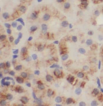 Immunohistochemistry Nardilysin Antibody - BSA Free