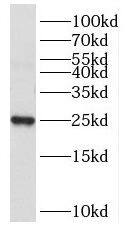 Western Blot Nucleoplasmin-3 Antibody - BSA Free