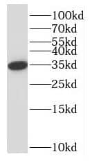Western Blot NPL Antibody - BSA Free