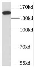 Western Blot NPHP3 Antibody - BSA Free