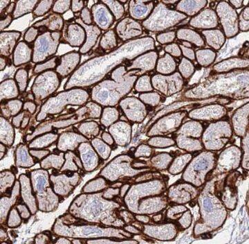 Immunohistochemistry NPHP3 Antibody - BSA Free