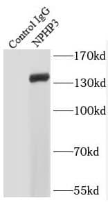 Immunoprecipitation NPHP3 Antibody - BSA Free