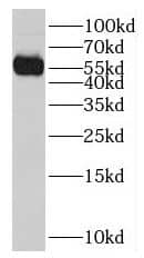 Western Blot: NPEPL1 Antibody - BSA Free [NBP3-47316] - HepG2 cells were subjected to SDS PAGE followed by western blot with (NPEPL1 antibody) at dilution of 1:50