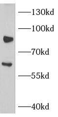 Immunohistochemistry: NOX5 Antibody - BSA Free [NBP3-47318] - Immunohistochemistry of paraffin-embedded human testis tissue slide using (NOX5 Antibody) at dilution of 1:200