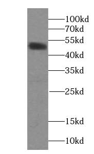 Western Blot: NOX3 Antibody - BSA Free [NBP3-47319] - Human brain tissue were subjected to SDS PAGE followed by western blot with (NOX3 antibody) at dilution of 1:500