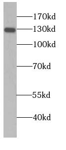 Western Blot: NOMO2 Antibody - BSA Free [NBP3-47323] - BxPC-3 cells were subjected to SDS PAGE followed by western blot with (NOMO2 antibody) at dilution of 1:300