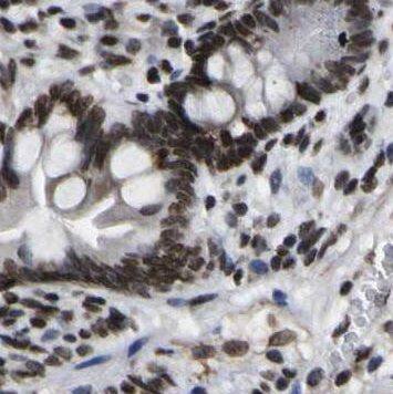 Immunohistochemistry NOMO1 Antibody - BSA Free