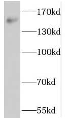 Western Blot: NOL8 Antibody - BSA Free [NBP3-47326] - SGC-7901 cells were subjected to SDS PAGE followed by western blot with (NOL8 antibody) at dilution of 1:500