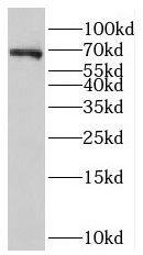 Western Blot: NOL4 Antibody - BSA Free [NBP3-47327] - Mouse brain tissue were subjected to SDS PAGE followed by western blot with (NOL4 antibody) at dilution of 1:800