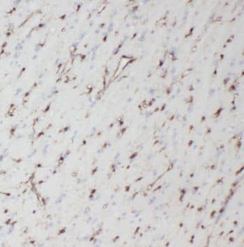 Immunohistochemistry Neuromedin UR1/NMUR1 Antibody - BSA Free