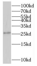 Western Blot: NMNAT3 Antibody - BSA Free [NBP3-47330] - Mouse kidney tissue were subjected to SDS PAGE followed by western blot with ( NMNAT3 Antibody) at dilution of 1:300