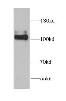 Western Blot Neuroligin 4Y/NLGN4Y Antibody - BSA Free