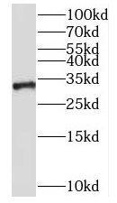 Western Blot NKX1-2 Antibody - BSA Free