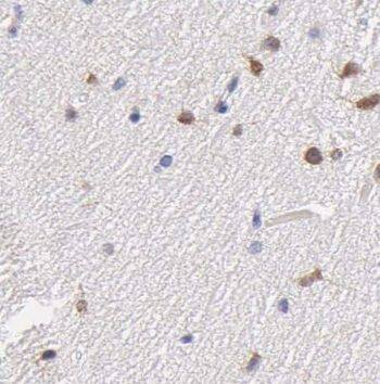 Immunohistochemistry: NKX1-2 Antibody - BSA Free [NBP3-47334] - Immunohistochemistry of paraffin-embedded human brain tissue slide using (NKX1-2 Antibody) at dilution of 1:50