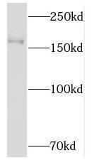 Western Blot NKTR Antibody - BSA Free