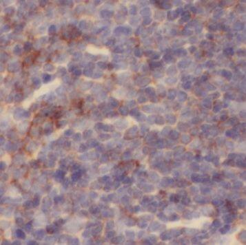 Immunohistochemistry NKTR Antibody - BSA Free