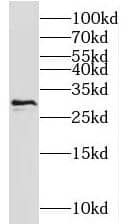 Western Blot: NIPSNAP3A Antibody - BSA Free [NBP3-47339] - Mouse brain tissue were subjected to SDS PAGE followed by western blot with (NIPSNAP3A antibody) at dilution of 1:1000