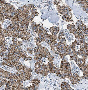 Immunohistochemistry NIPSNAP3A Antibody - BSA Free