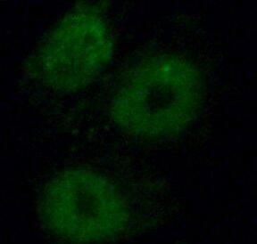 Immunocytochemistry/ Immunofluorescence: NHP2 Antibody - BSA Free [NBP3-47342] - Immunofluorescent analysis of HepG2 cells using  (NPH2 Antibody) at dilution of 1:25