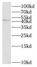Western Blot NHLRC1 Antibody - BSA Free