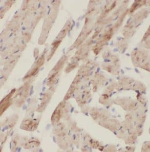 Immunohistochemistry NHLRC1 Antibody - BSA Free