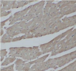Immunohistochemistry: IKB zeta Antibody - BSA Free [NBP3-47347] - Immunohistochemistry of paraffin-embedded mouse heart using (IKB zeta antibody) at dilution of 1:50