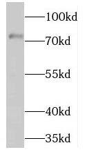 Western Blot: NRF3 Antibody - BSA Free [NBP3-47348] - Human placenta tissue were subjected to SDS PAGE followed by western blot with (NRF3 antibody) at dilution of 1:500
