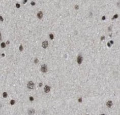 Immunohistochemistry Neuromedin B Antibody - BSA Free