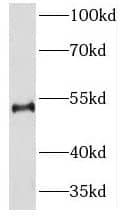 Western Blot NEUROD4 Antibody - BSA Free
