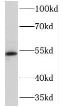 Western Blot NEU4 Antibody - BSA Free
