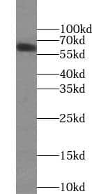 Western Blot: NTNG1 Antibody - BSA Free [NBP3-47355] - Mouse lung tissue were subjected to SDS PAGE followed by western blot with (NTNG1 antibody) at dilution of 1:500
