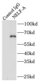 Immunoprecipitation: WHSC2 Antibody - BSA Free [NBP3-47357] - IP Result of anti-WHSC2 (IP:, 4ug; Detection: 1:500) with mouse brain tissue lysate 3440ug.