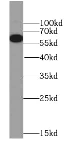 Western Blot: WHSC2 Antibody - BSA Free [NBP3-47357] - HeLa cells were subjected to SDS PAGE followed by western blot with ( WHSC2 Antibody) at dilution of 1:1000
