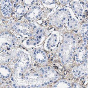 Immunohistochemistry: NDUFV3 Antibody - BSA Free [NBP3-47363] - Immunohistochemistry of paraffin-embedded human kidney tissue slide using (NDUFV3 Antibody) at dilution of 1:50