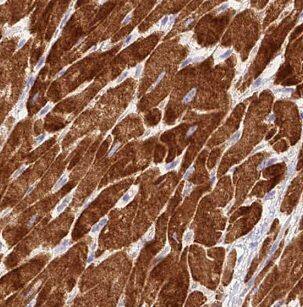 Immunohistochemistry: NDUFC1 Antibody - BSA Free [NBP3-47365] - Immunohistochemistry of paraffin-embedded human heart tissue slide using ( NDUFC1 Antibody) at dilution of 1:5