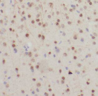 Immunohistochemistry: NDUFB7 Antibody - BSA Free [NBP3-47366] - Immunohistochemistry of paraffin-embedded human brain using (NDUFB7 antibody) at dilution of 1:100