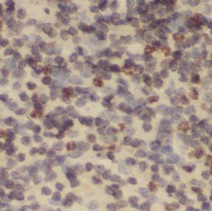 Immunohistochemistry: NDUFB2 Antibody - BSA Free [NBP3-47368] - Immunohistochemistry of paraffin-embedded human spleen using (NDUFB2 antibody) at dilution of 1:100