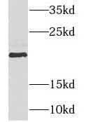Western Blot: NDUFAF4 Antibody - BSA Free [NBP3-47370] - K-562 cells were subjected to SDS PAGE followed by western blot with ( NDUFAF4 Antibody) at dilution of 1:1200