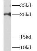 Western Blot NDUFAF2 Antibody - BSA Free