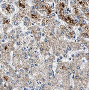 Immunohistochemistry: NDUFAF2 Antibody - BSA Free [NBP3-47371] - Immunohistochemistry of paraffin-embedded human liver using (NDUFAF2 antibody) at dilution of 1:100