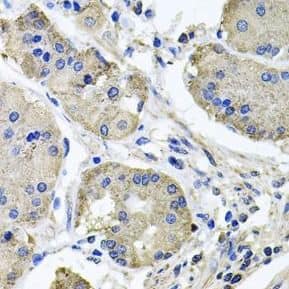 Immunohistochemistry NDUFA6 Antibody - BSA Free